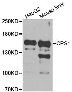 CPS1 Polyclonal Antibody:Antibodies, Polyclonal