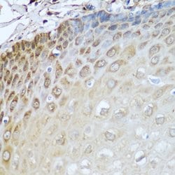 Invitrogen Alcohol Dehydrogenase 1C Polyclonal Antibody 100 &mu;L; Unconjugated:Antibodies,