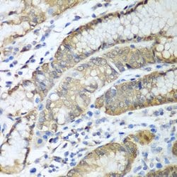 Invitrogen Alcohol Dehydrogenase 1C Polyclonal Antibody 100 &mu;L; Unconjugated:Antibodies,