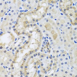 Invitrogen Centrin 3 Polyclonal Antibody 100 &mu;L; Unconjugated:Antibodies,