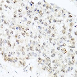 Invitrogen Centrin 3 Polyclonal Antibody 100 &mu;L; Unconjugated:Antibodies,