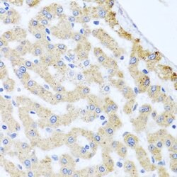 Invitrogen Centrin 3 Polyclonal Antibody 100 &mu;L; Unconjugated:Antibodies,