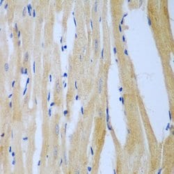 Invitrogen MGAT3 Polyclonal Antibody 100 &mu;L; Unconjugated:Antibodies,