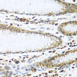 Invitrogen IFI44 Polyclonal Antibody 100 &mu;L; Unconjugated:Antibodies,