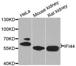 Invitrogen IFI44 Polyclonal Antibody 100 &mu;L; Unconjugated:Antibodies,
