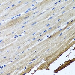 Invitrogen TTLL12 Polyclonal Antibody 100 &mu;L; Unconjugated:Antibodies,