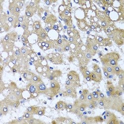 Invitrogen TTLL12 Polyclonal Antibody 100 &mu;L; Unconjugated:Antibodies,