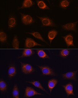Invitrogen METTL7A Polyclonal Antibody 100 &mu;L; Unconjugated:Antibodies,