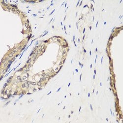 Invitrogen METTL7A Polyclonal Antibody 100 &mu;L; Unconjugated:Antibodies,