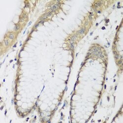 Invitrogen METTL7A Polyclonal Antibody 100 &mu;L; Unconjugated:Antibodies,