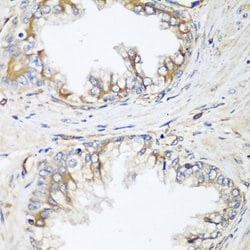 Invitrogen HPa2 Polyclonal Antibody 100 &mu;L; Unconjugated:Antibodies,