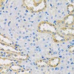 Invitrogen HS1BP3 Polyclonal Antibody 100 &mu;L; Unconjugated:Antibodies,