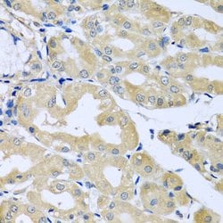 Invitrogen HS1BP3 Polyclonal Antibody 100 &mu;L; Unconjugated:Antibodies,