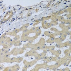 Invitrogen ATAD3B Polyclonal Antibody 100 &mu;L; Unconjugated:Antibodies,