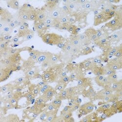 Invitrogen AP1M2 Polyclonal Antibody 100 &mu;L; Unconjugated:Antibodies,