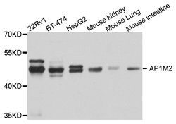 Invitrogen AP1M2 Polyclonal Antibody 100 &mu;L; Unconjugated:Antibodies,