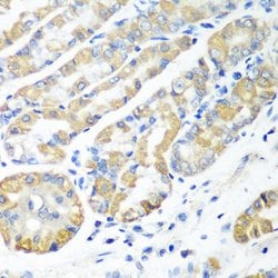 Invitrogen MSRB2 Polyclonal Antibody 100 &mu;L; Unconjugated:Antibodies,