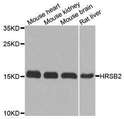 Invitrogen MSRB2 Polyclonal Antibody 100 &mu;L; Unconjugated:Antibodies,
