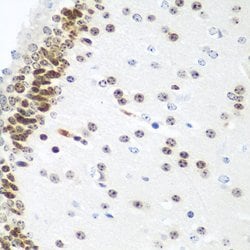 Invitrogen UBE2U Polyclonal Antibody 100 &mu;L; Unconjugated:Antibodies,