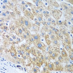 Invitrogen UBE2U Polyclonal Antibody 100 &mu;L; Unconjugated:Antibodies,