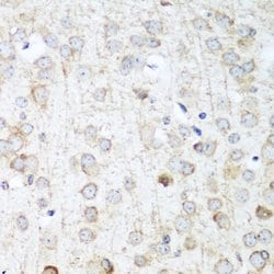 Invitrogen ANR52 Polyclonal Antibody 100 &mu;L; Unconjugated:Antibodies,