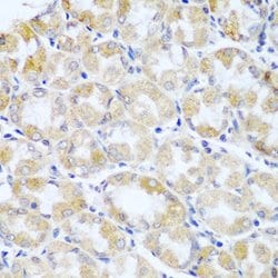 Invitrogen ANR52 Polyclonal Antibody 100 &mu;L; Unconjugated:Antibodies,
