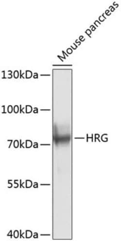 Invitrogen HRG Polyclonal Antibody 100 &mu;L; Unconjugated:Antibodies,