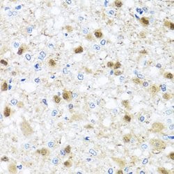 Invitrogen ZBTB17 Polyclonal Antibody 100 &mu;L; Unconjugated:Antibodies,