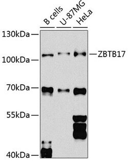 Invitrogen ZBTB17 Polyclonal Antibody 100 &mu;L; Unconjugated:Antibodies,