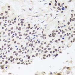 Invitrogen RPP30 Polyclonal Antibody 100 &mu;L; Unconjugated:Antibodies,