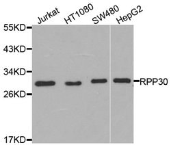 Invitrogen RPP30 Polyclonal Antibody 100 &mu;L; Unconjugated:Antibodies,