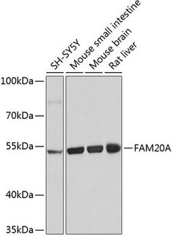 Invitrogen FAM20A Polyclonal Antibody 100 &mu;L | Buy Online | Invitrogen&trade; | Fisher Scientific