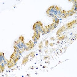 Invitrogen PCDHA12 Polyclonal Antibody 100 &mu;L; Unconjugated:Antibodies,
