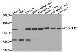 Invitrogen PCDHA12 Polyclonal Antibody 100 &mu;L; Unconjugated:Antibodies,