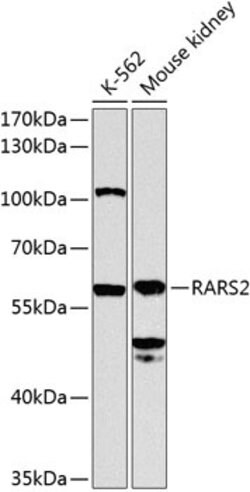 Invitrogen RARS2 Polyclonal Antibody 100 &mu;L; Unconjugated:Antibodies,