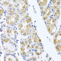 TMEM43 Polyclonal Antibody:Antibodies, Polyclonal