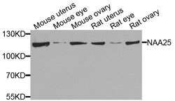 Invitrogen C12orf30 Polyclonal Antibody 100 &mu;L; Unconjugated:Antibodies,