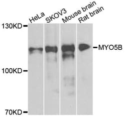 Invitrogen MYO5B Polyclonal Antibody 100 &mu;L | Buy Online | Invitrogen&trade; | Fisher Scientific