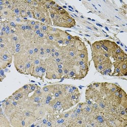 Invitrogen Thrombospondin 2 Polyclonal Antibody 100 &mu;L; Unconjugated:Antibodies,