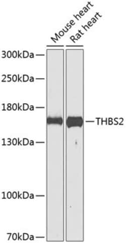 Invitrogen Thrombospondin 2 Polyclonal Antibody 100 &mu;L; Unconjugated:Antibodies,