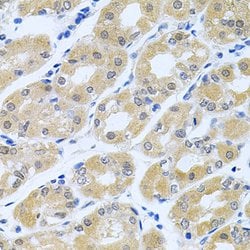 Invitrogen GNE Polyclonal Antibody 100 &mu;L; Unconjugated:Antibodies,