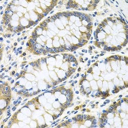 Invitrogen GNE Polyclonal Antibody 100 &mu;L; Unconjugated:Antibodies,