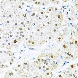 Invitrogen BCCIP Polyclonal Antibody 100 &mu;L | Buy Online | Invitrogen&trade; | Fisher Scientific