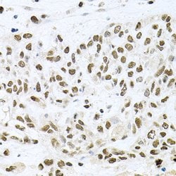 Invitrogen BCCIP Polyclonal Antibody 100 &mu;L | Buy Online | Invitrogen&trade; | Fisher Scientific