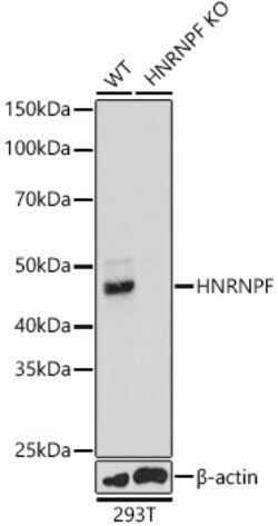 Invitrogen hnRNP F Polyclonal Antibody 100 &mu;L | Buy Online | Invitrogen&trade; | Fisher Scientific