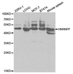 Invitrogen hnRNP F Polyclonal Antibody 100 &mu;L | Buy Online | Invitrogen&trade; | Fisher Scientific
