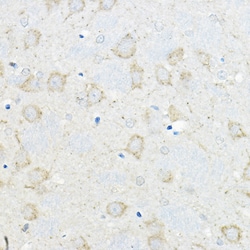 Invitrogen GIPR Polyclonal Antibody 100 &mu;L; Unconjugated:Antibodies,