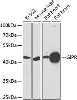 Invitrogen GIPR Polyclonal Antibody 100 &mu;L; Unconjugated:Antibodies,