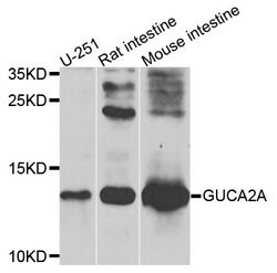 Invitrogen GUCA2A Polyclonal Antibody 100 &mu;L; Unconjugated:Antibodies,