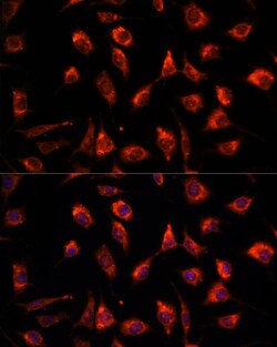 Invitrogen TPT1 Polyclonal Antibody 100 &mu;L | Buy Online | Invitrogen&trade; | Fisher Scientific
